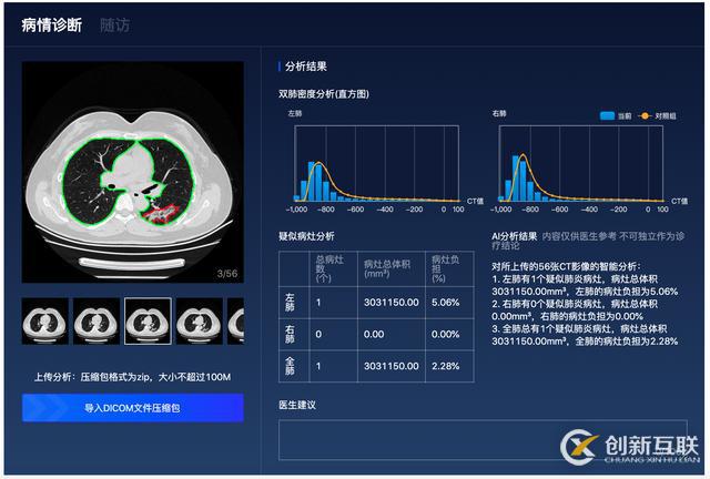 百度「AI戰(zhàn)疫」：首次開源肺炎CT影像分析模型，讓診斷從分鐘到秒